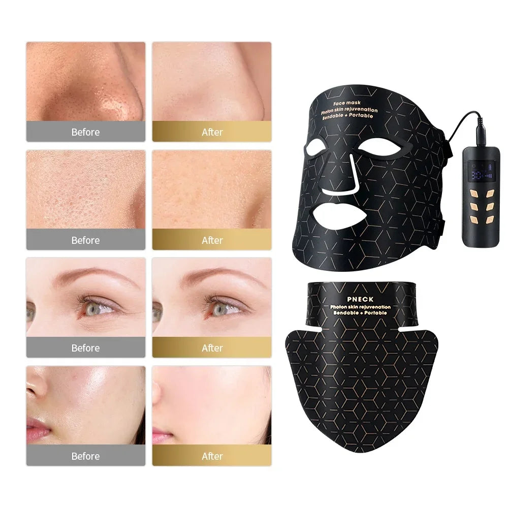 4Color Silicone Facial Neck Mask Anti Aging Skin Rejuvenation Brighten Beauty Face Photon Mask