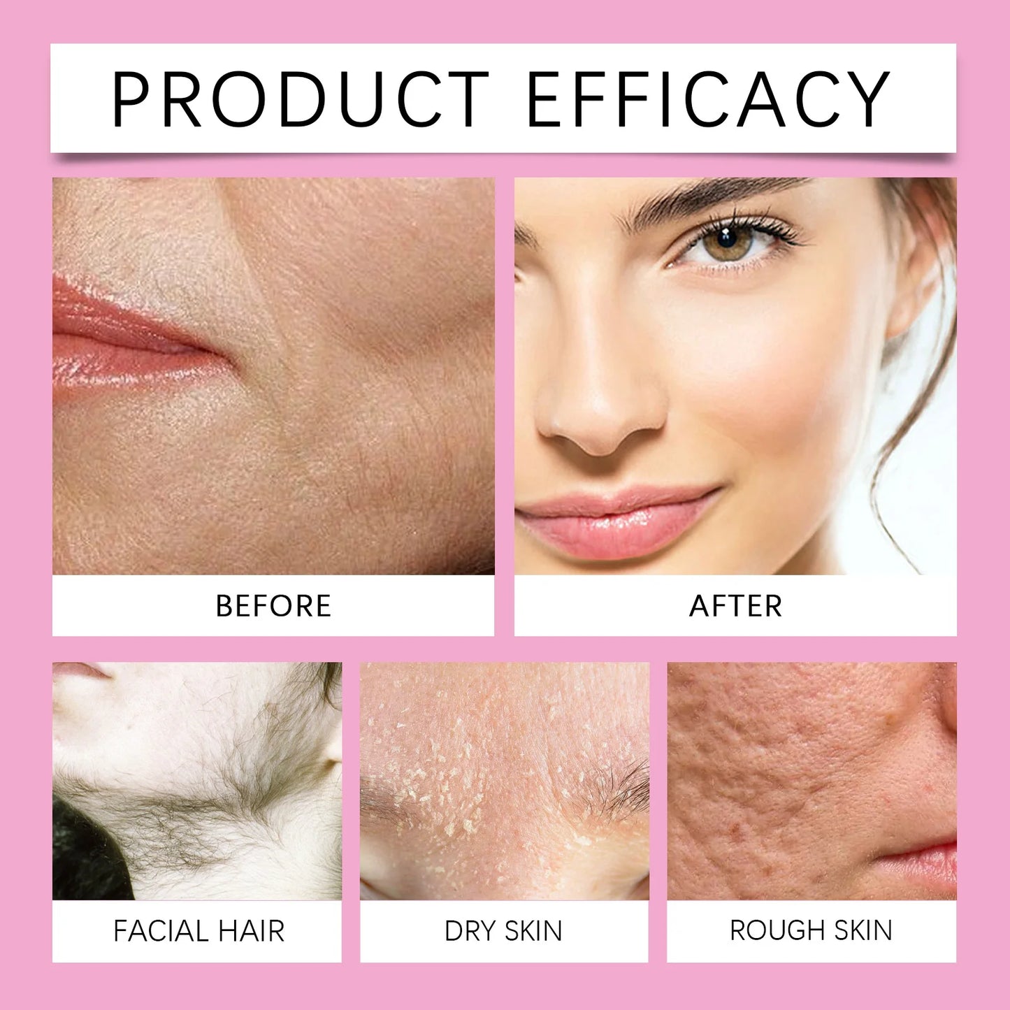100ml Scraper Removal Spray Permanent Gentle Shaving Depilator Intimate Areas Body Hair  Inhibitor Painless Powerful Epilator